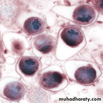 Respiratory