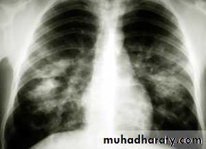 Respiratory