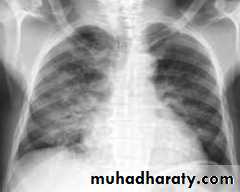 Respiratory