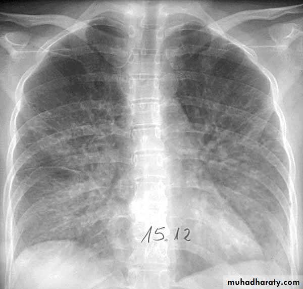 Respiratory