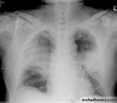 Respiratory
