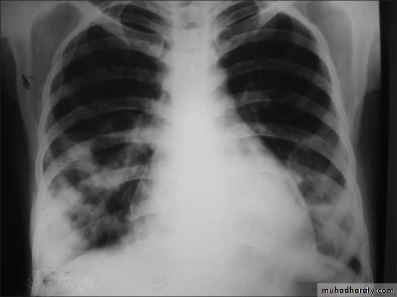 Respiratory
