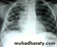 Respiratory