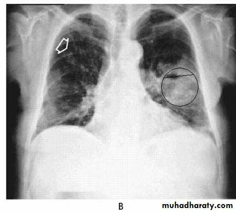 Respiratory