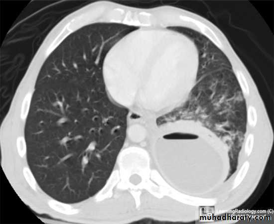 Respiratory