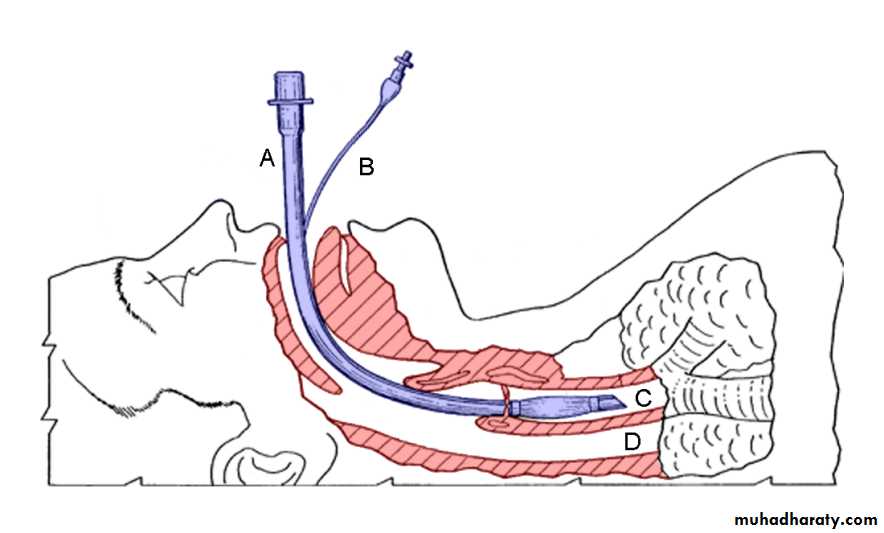Respiratory