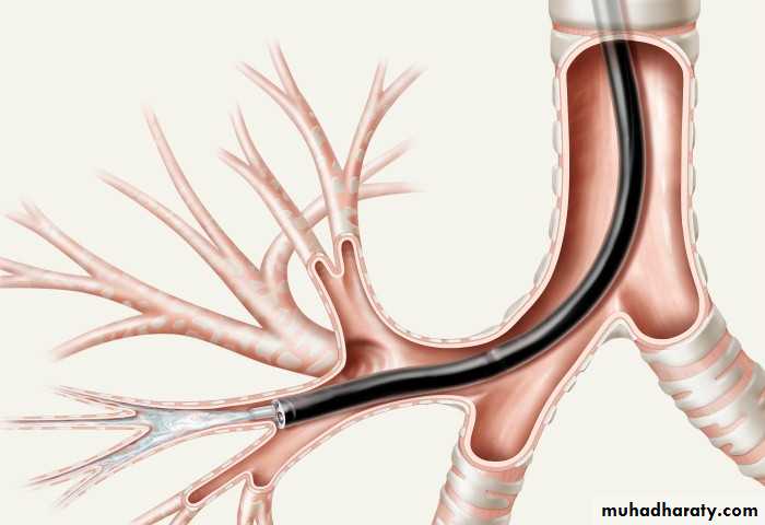 Respiratory