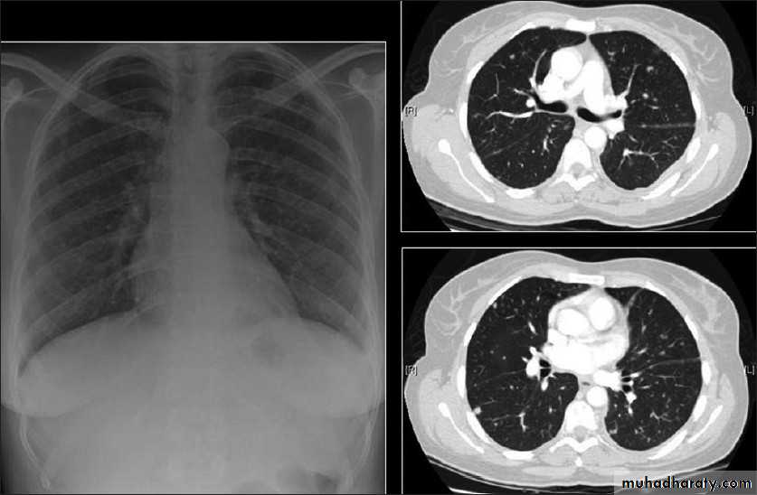 Respiratory