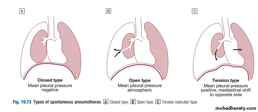 Respiratory
