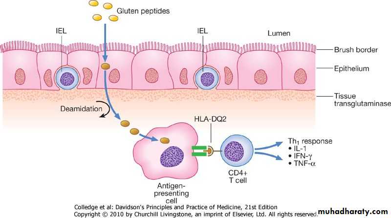 Celiac disease