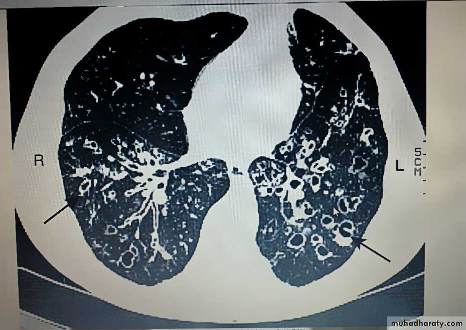 Respiratory system