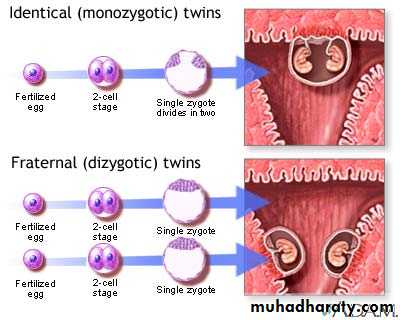 Multiple pregnancy