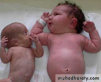 Prolonged Pregnancies