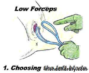 Obstetric procedures