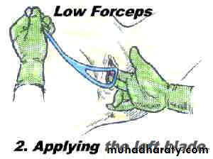 Obstetric procedures