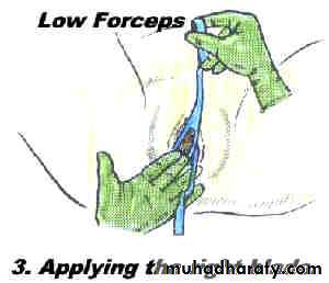 Obstetric procedures