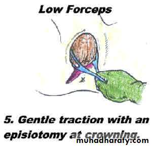 Obstetric procedures
