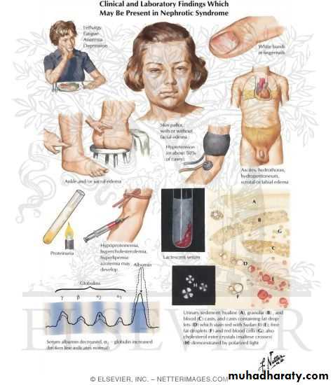 PROTINUREA