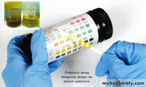 PROTINUREA