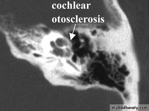 INNER EAR