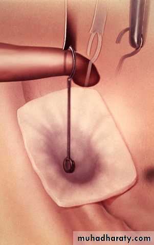INNER EAR