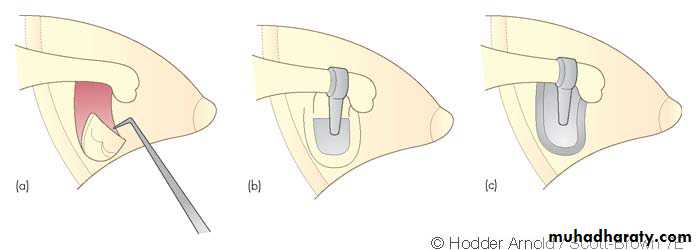 INNER EAR
