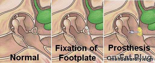 INNER EAR
