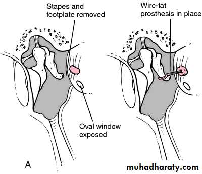 INNER EAR
