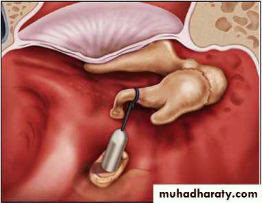 INNER EAR