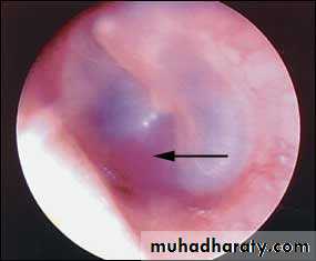 INNER EAR