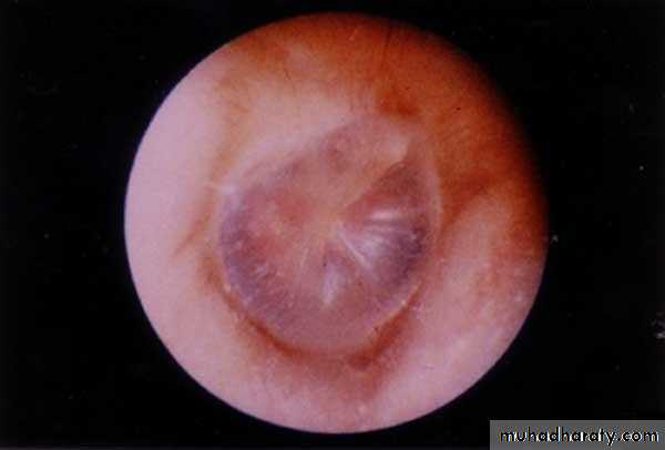 INNER EAR