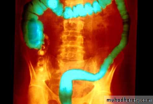 Small bowel