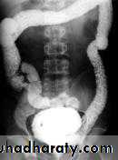Small bowel