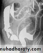 Small bowel