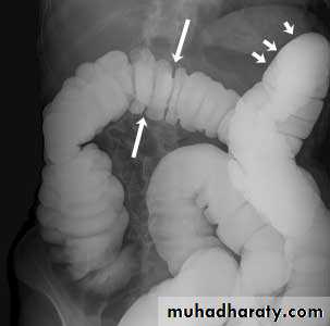 Small bowel