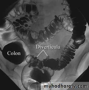 Small bowel