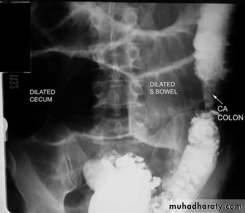 Small bowel