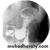Small bowel