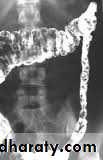 Small bowel