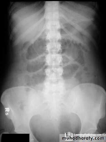 Small bowel