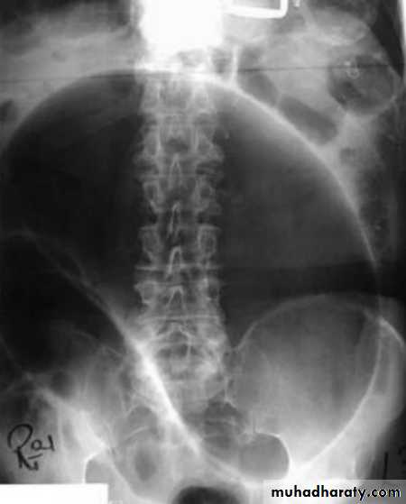 Small bowel