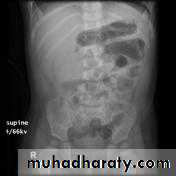Small bowel