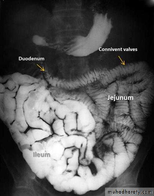 Small bowel