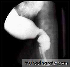 Small bowel