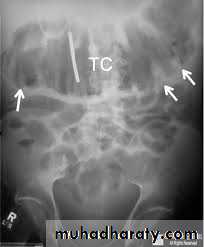 Small bowel