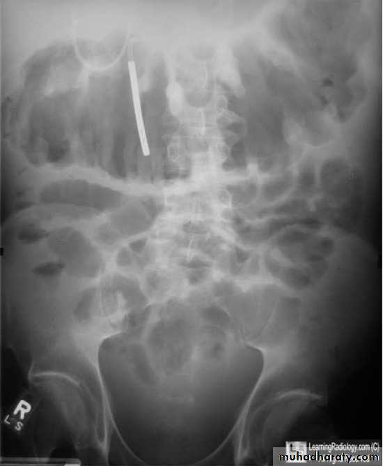 Small bowel