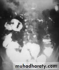 Small bowel