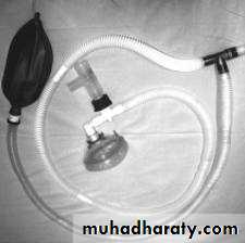 Oxygen Therapy and Airway Management Ventilator therapy