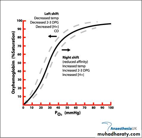 Oxygen Therapy and Airway Management Ventilator therapy