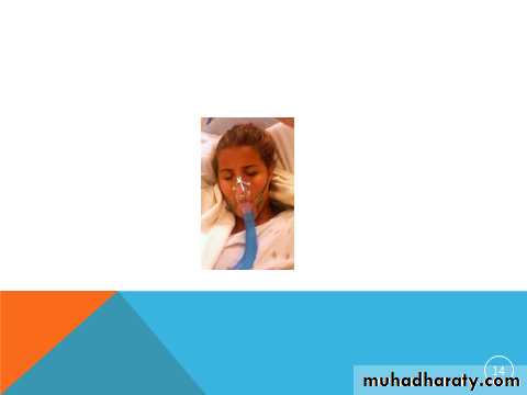 Oxygen Therapy and Airway Management Ventilator therapy